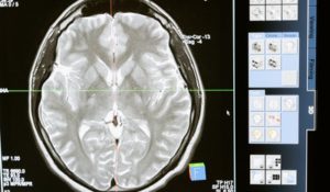 Cloud Storage Improves Life Sciences Data Storage