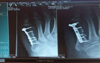 Medical Record Storage and PACS Archiving: Challenges & StoneFly’s Solutions